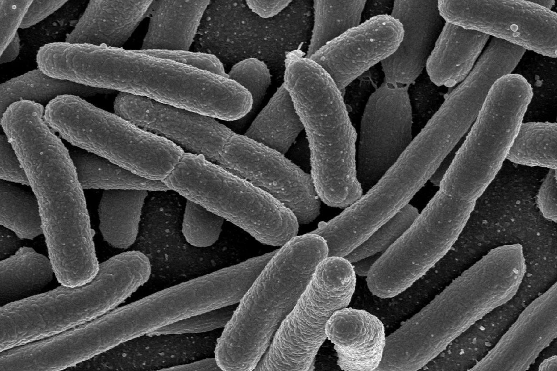 E.-coli.jpg